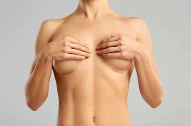 Mamoplastia aumento Bogotá