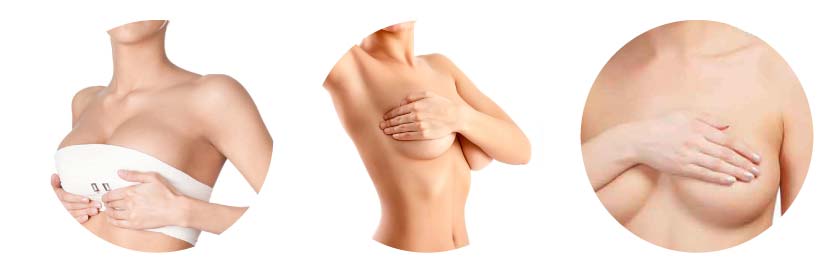 Mamoplastia de aumento cirugia mamoplastia de aumento