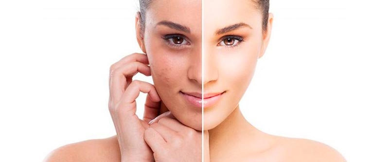 Los mejores tratamientos de medicina estética en Bogotá